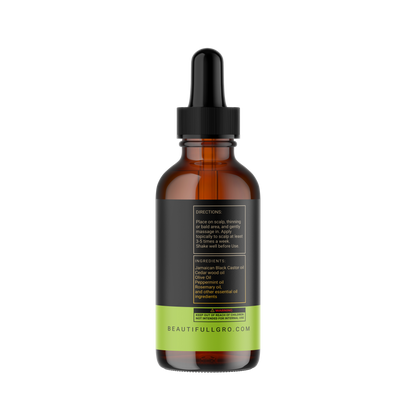 Hair Growth Oil for Hair Loss, Alopecia & Scalp Health – 4 oz