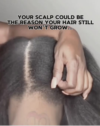 Hair Growth Oil for Hair Loss, Alopecia & Scalp Health – 2 oz